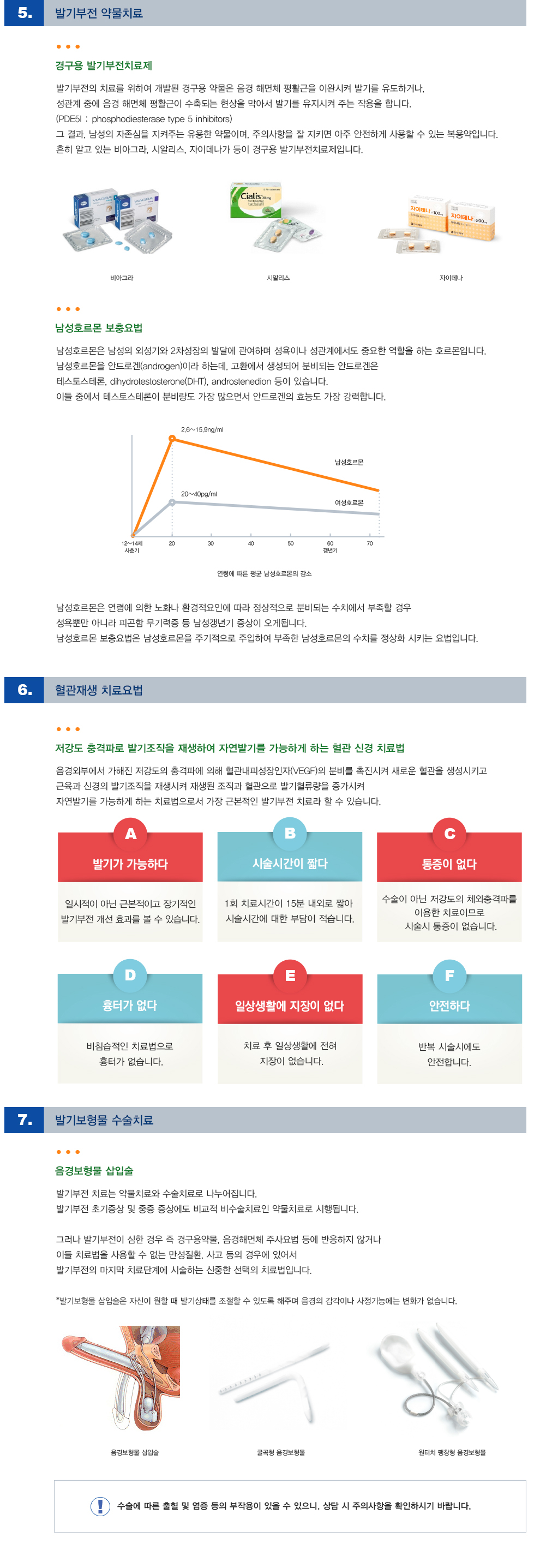 발기부전